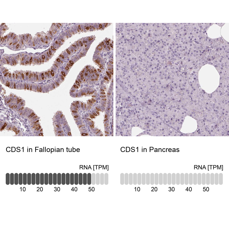 Anti-CDS1 Antibody