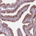 Immunohistochemical staining of human fallopian tube shows high expression.