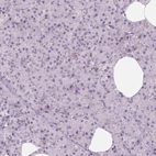 Immunohistochemical staining of human pancreas shows low expression as expected.