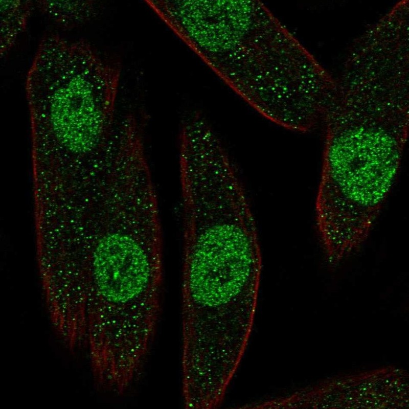 Anti-PAX8 Antibody