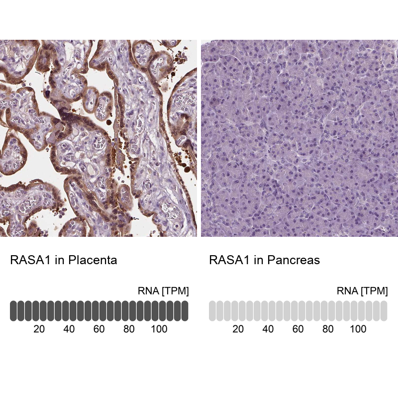 Anti-RASA1 Antibody