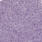 Anti-RASA1 Antibody