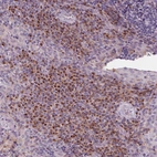Anti-IL9R Antibody