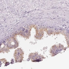 Immunohistochemical staining of human prostate shows moderate cytoplasmic positivity in glandular cells.