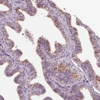 Immunohistochemical staining of human fallopian tube shows moderate cytoplasmic positivity in glandular cells.
