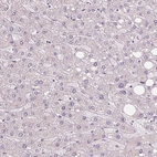 Immunohistochemical staining of human liver shows no positivity in hepatocytesas expected.