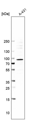 Anti-SFMBT1 Antibody