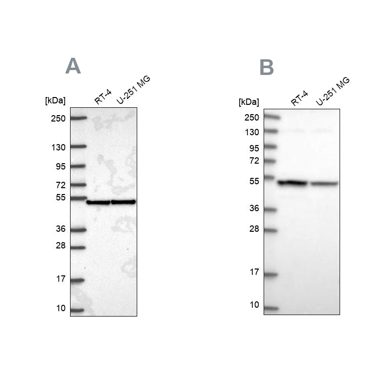 Anti-IPO4 Antibody