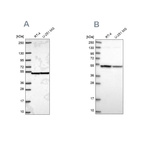 Anti-IPO4 Antibody