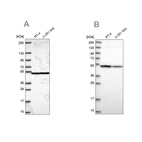 Anti-IPO4 Antibody