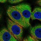 Immunofluorescent staining of human cell line MCF7 shows localization to cytosol.