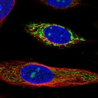 Immunofluorescent staining of human cell line SiHa shows localization to nucleoli & mitochondria.