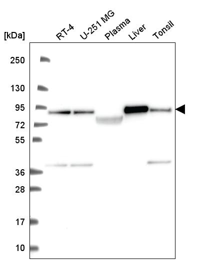 Anti-NDUFS1 Antibody