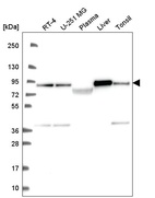 Anti-NDUFS1 Antibody