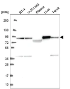 Anti-NDUFS1 Antibody