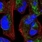 Immunofluorescent staining of human cell line RH-30 shows localization to mitochondria.