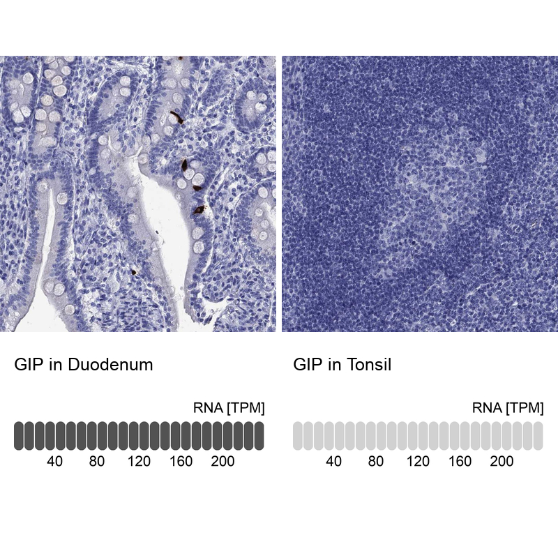 Anti-GIP Antibody
