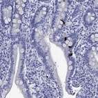 Immunohistochemical staining of human duodenum shows high expression.