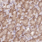 Anti-ADAM8 Antibody