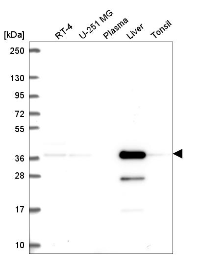 Anti-AKR7A2 Antibody