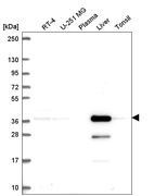 Anti-AKR7A2 Antibody