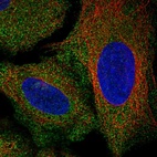 Anti-AKR7A2 Antibody