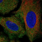 Immunofluorescent staining of human cell line U-2 OS shows localization to cytosol.
