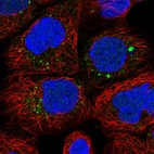 Anti-ANKRD6 Antibody