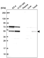 Anti-SF3B4 Antibody