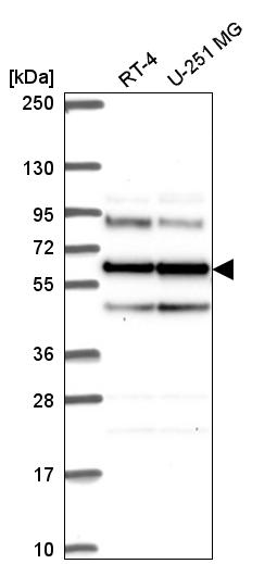 Anti-SARS Antibody
