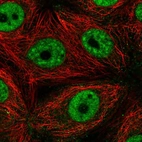 Immunofluorescent staining of human cell line MCF7 shows localization to nuclear speckles.