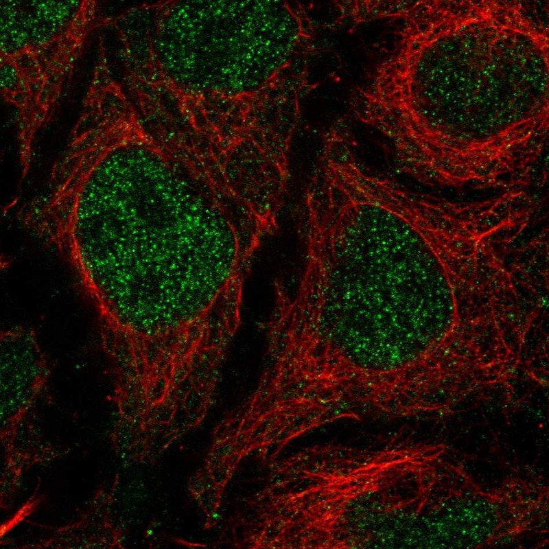 Anti-TMEM8A Antibody