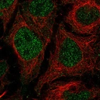 Anti-TMEM8A Antibody