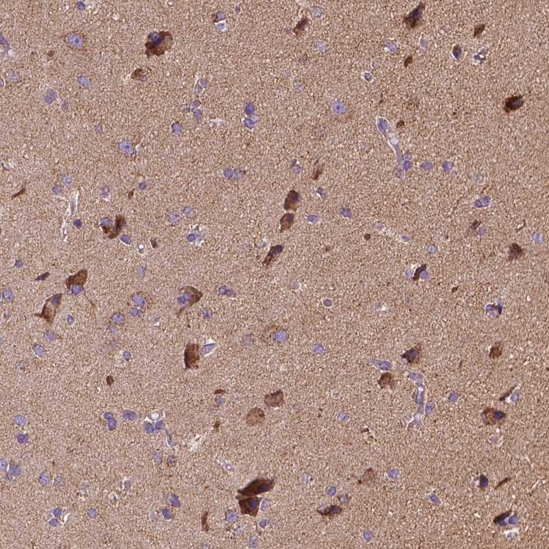 Anti-SNCAIP Antibody