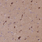 Anti-SNCAIP Antibody