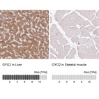 Anti-GYG2 Antibody