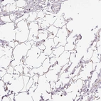 Immunohistochemical staining of human adipose tissue shows strong cytoplasmic positivity in adipocytes.