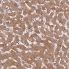 Immunohistochemical staining of human liver shows strong cytoplasmic positivity in hepatocytes.