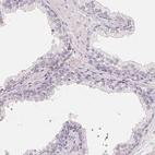 Immunohistochemical staining of human prostate shows no cytoplasmic positivity in glandular cells as expected.