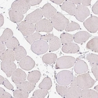 Immunohistochemical staining of human skeletal muscle shows no cytoplasmic positivity in myocytes as expected.