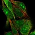 Immunofluorescent staining of human cell line SK-MEL-30 shows localization to nucleus, nucleoli & cytosol.