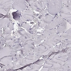Immunohistochemical staining of human skeletal muscle shows low expression as expected.