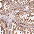 Anti-PRMT5 Antibody