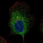 Immunofluorescent staining of human cell line U-2 OS shows localization to endoplasmic reticulum.