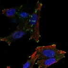 Anti-NEDD4L Antibody