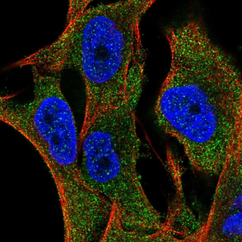 Anti-SLC35G2 Antibody