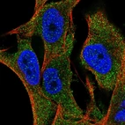 Anti-SLC35G2 Antibody