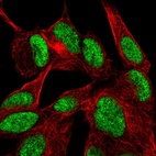 Immunofluorescent staining of human cell line SH-SY5Y shows localization to nucleoplasm.