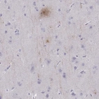 Immunohistochemical staining of human cerebral cortex shows strong positivity in neuronal processes.