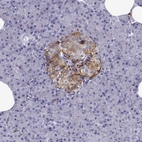 Immunohistochemical staining of human pancreas shows strong cytoplasmic positivity in islets of Langerhans.